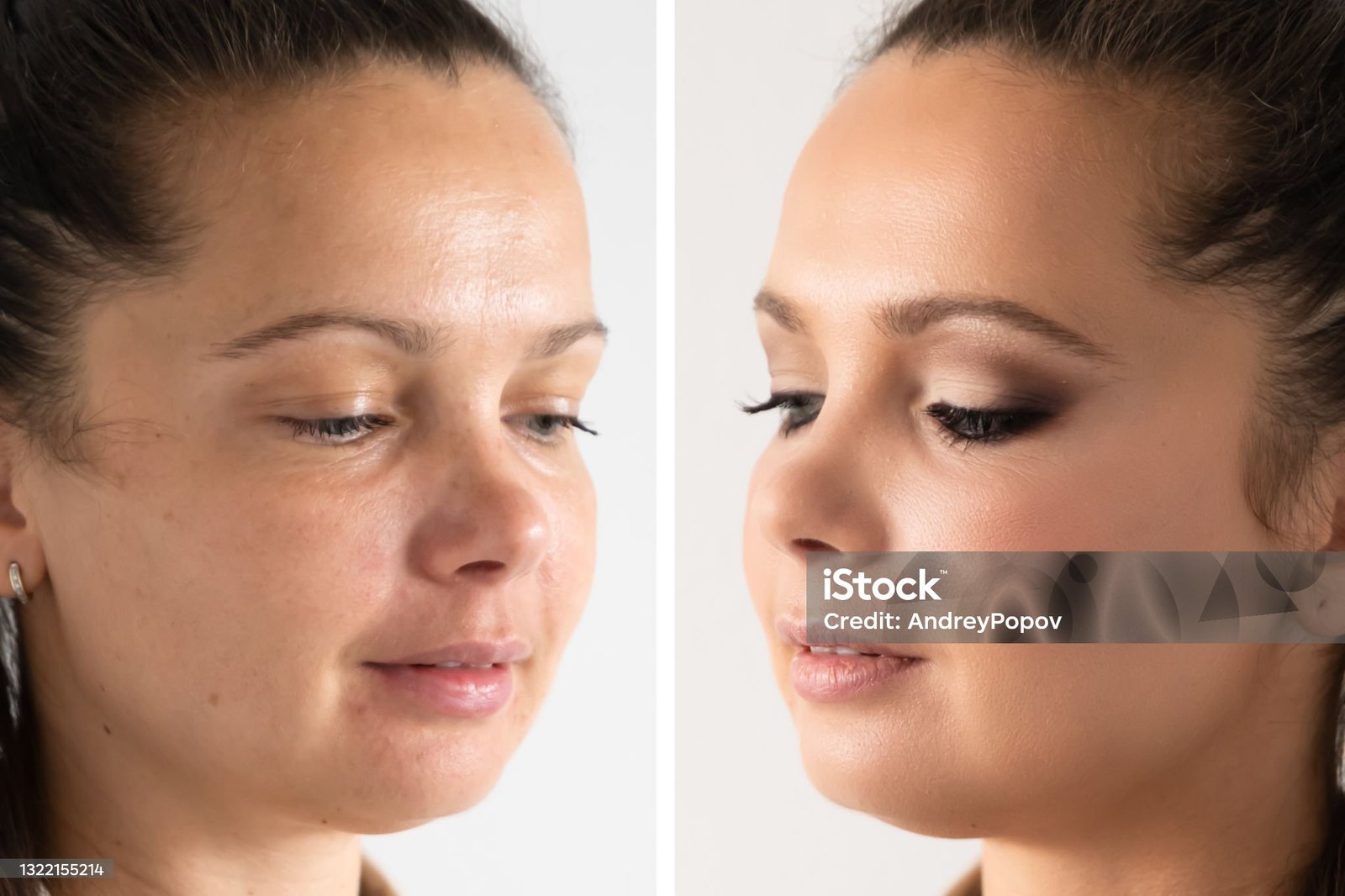 Woman Face Skin Make Up. Comparing Before And After